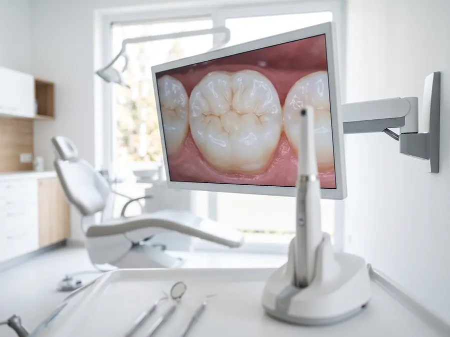 An intraoral camera in its holder, with an enlarged image of a molar on a chairside screen.